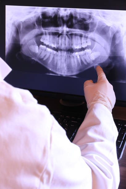 Best Emergency Dentist for Knocked-Out Tooth in Knob Noster, MO