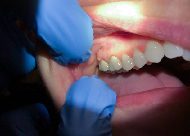 Best Broken or Cracked Tooth Emergency Dentist in Knob Noster, MO